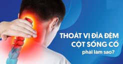 Triệu chứng chữa thoái hóa đốt sống cổ và cách điều trị