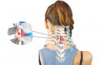 Chữa Gai Cột Sống Cổ Rất Dễ Dàng Không Khó Như Bạn Nghĩ