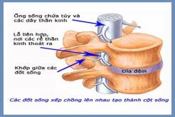 Phình đĩa đệm có chữa được không nguyên nhân và triệu chứng