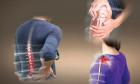 Nguyên nhân và cách điều trị bệnh đau thần kinh tọa