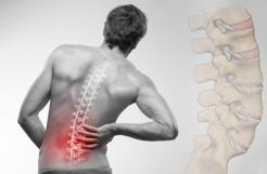 Bệnh đau vai gáy và cách điều trị như thế nào